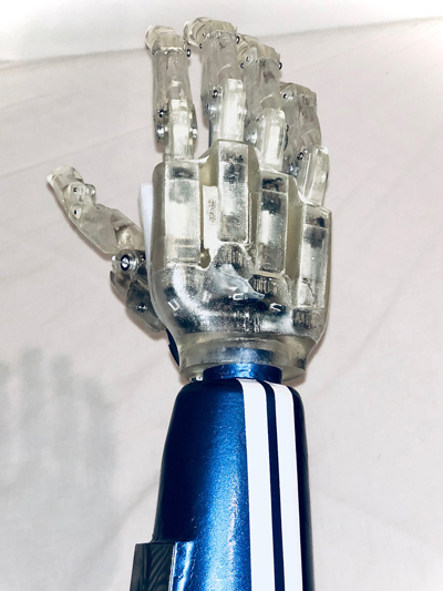 low cost prosthesis hand  bionic hand robot hand 電動義手 筋電義手